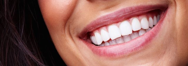 close up of woman's smiling teeth